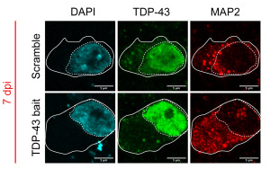Cell Stem Cell：利用類器官保護(hù)癡呆和ALS中受到的腦損傷