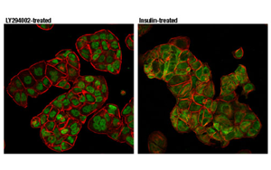 Nature最新發(fā)現(xiàn)控制CAR-T細(xì)胞壽命的蛋白質(zhì)！