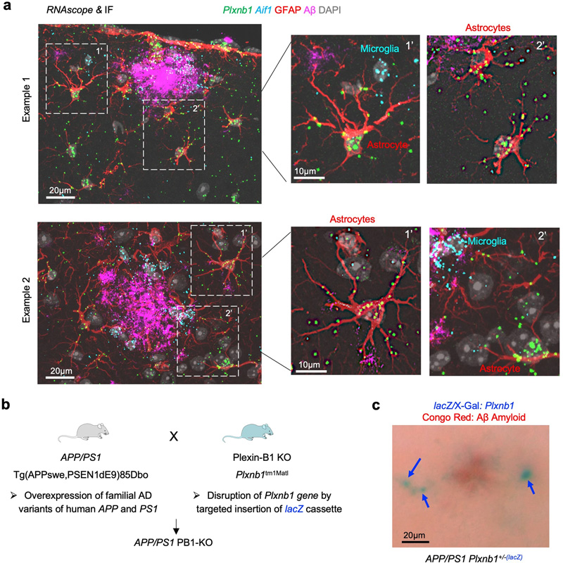 Plexin-B1在APP/PS1小鼠AD模型的斑塊周圍星形膠質(zhì)細(xì)胞中上調(diào)